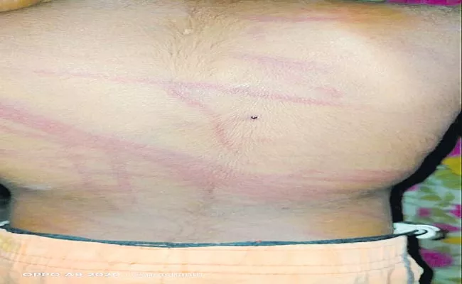 Father Tortured His Three Year Old Son In Medak District - Sakshi