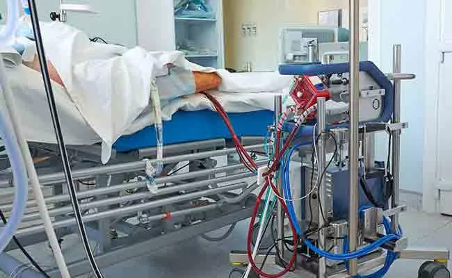 ECMO Therapy: An Advanced Form of Life Support That Saves Lives - Sakshi