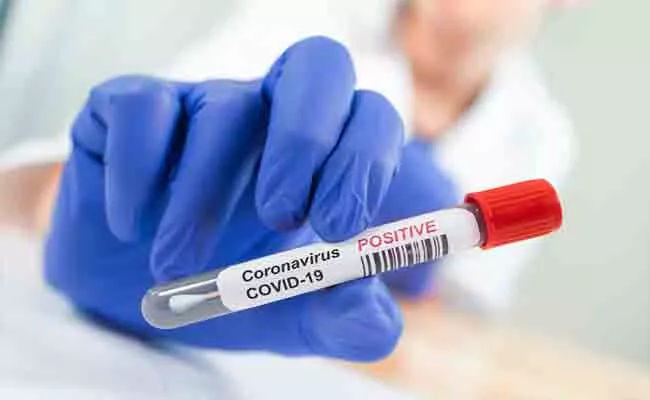Corona Virus Updates New Cases In Telangana - Sakshi
