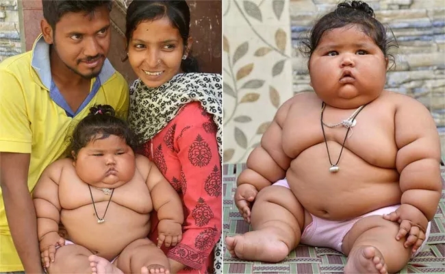 Eight Month Old Baby Weight 17 Kgs And Have Thick Skinned - Sakshi