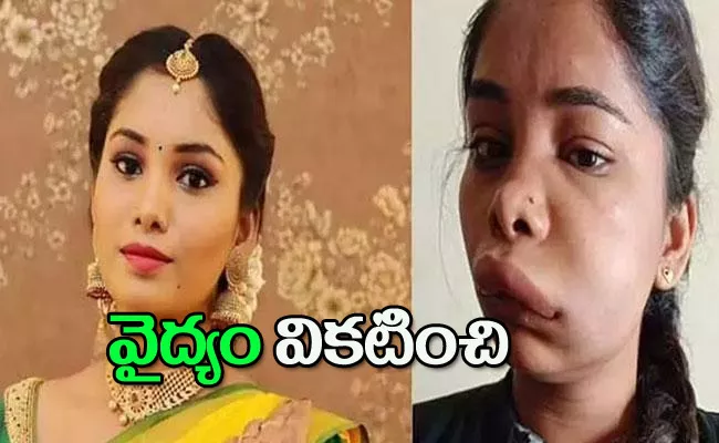 Actress Swathi Sathish Gets Swollen Face After Root Canal Surgery - Sakshi