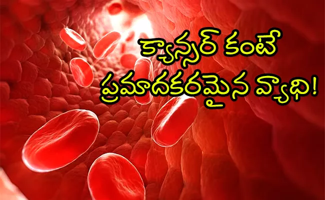 World Sepsis Day 2023: What Is Sepsis Why More Dangerous Than Cancer - Sakshi