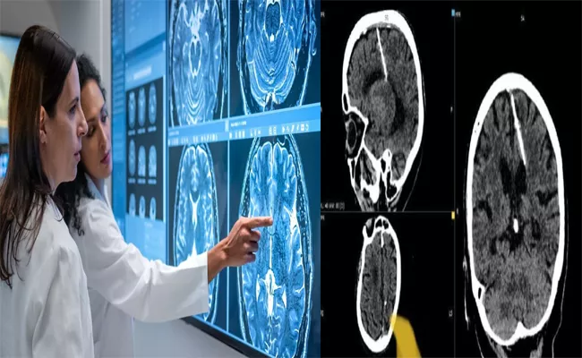 Doctors Discover Needle Lodged in 80 Year Old Womans Brain - Sakshi