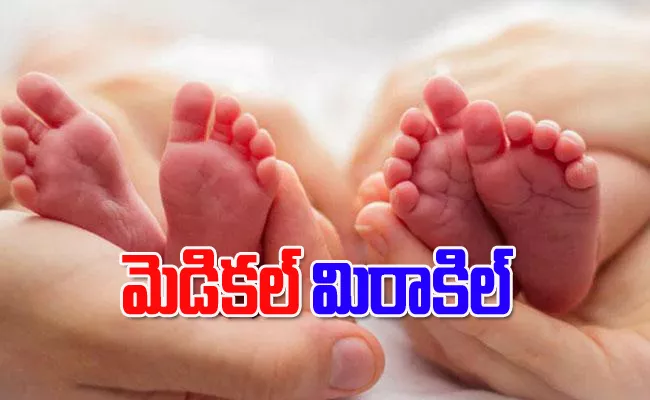 Twins Born In Two Different Years After 40 Minutes Apart - Sakshi