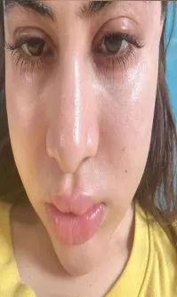 Urfi Javed shares shocking pictures of her face in instagram