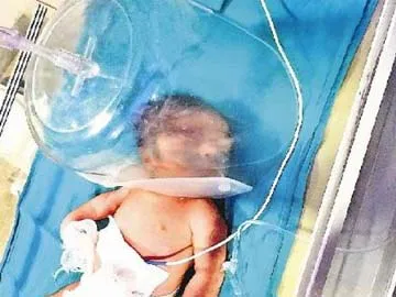 Farrukhabad 49 children die due to lack of oxygen