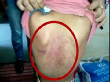 Principal Beat School children in Hyderabad