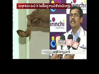 Hyderabad doctor performs rare Operation