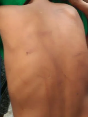 Girl alleges harassment by stepfather