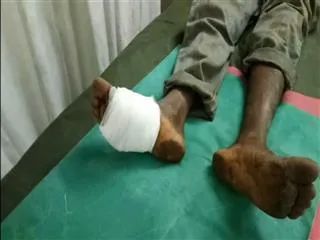 Maniac attack with knife in Kukatpally - Sakshi