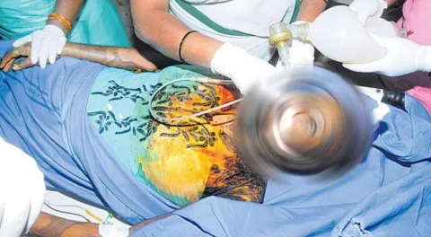 Acid attack on married women - Sakshi