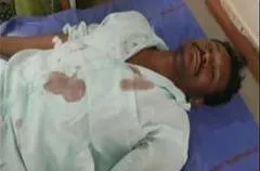 Clinical Trails failed ,80 people joined in Hospital - Sakshi