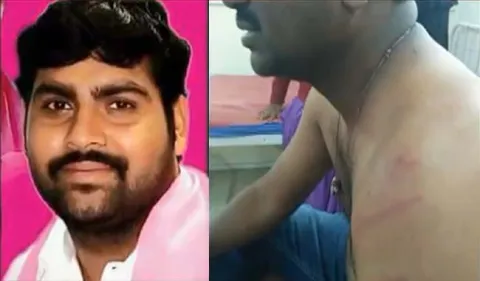 TRS leader attack  on loan recovery agent  in hyderabad - Sakshi