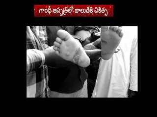 The child beaten by Mother in hyderabad - Sakshi