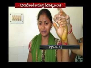 Street dogs bite 3 Children at LB Nagar in Hyderabad - Sakshi