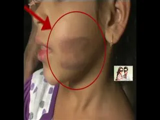 Man burns child cheeks and hands in domalguda - Sakshi
