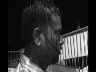 RTC Strike : Contract Drivers and Conductors injured - Sakshi