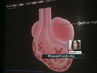 Unique operation held in Care Hospitals - Sakshi