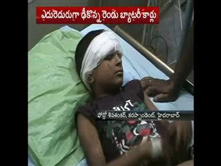 Battery cars hit ,child injured in Lumbini park - Sakshi