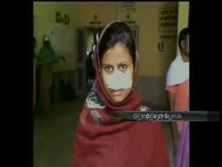 Man Allegedly Chops Off Wife's Hair, Nose for Dowry - Sakshi