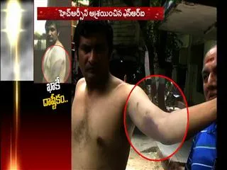 Musheerabad police beat NRI || NRI complaints to HRC - Sakshi