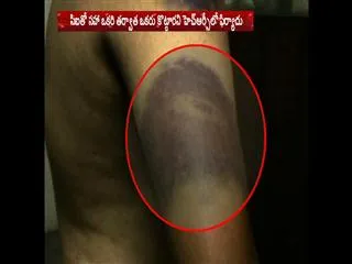 NRI beaten by Hyderabad police || Two Inspectors suspended - Sakshi