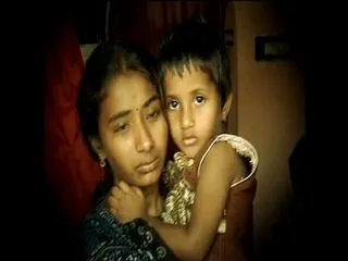 Girl Child Sufferd with Polio in Vishakhapatnam - Sakshi