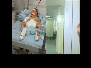 SI Siddaiah's Son on ventilator at Rainbow Hospital - Sakshi