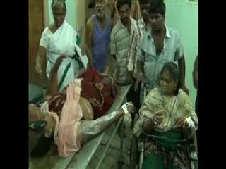 Man attacks acid on mother and daughter at krishna district - Sakshi