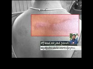 Woman attacked by pawnbrokers in Hyderabad - Sakshi