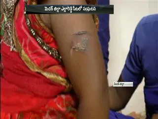 Child Punished By Anganwadi Aaya in Medak District - Sakshi