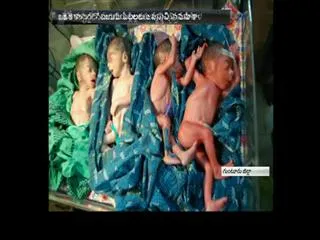 Four babies born in the one delivery - Sakshi