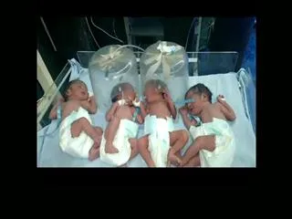 Four babies born in the same delivery - Sakshi