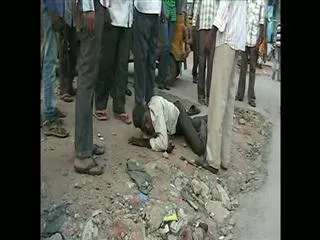 Kalthi Kallu People's Death Cases Increasing - Sakshi