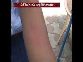Teacher beats student for coming late to school in hyderabad - Sakshi