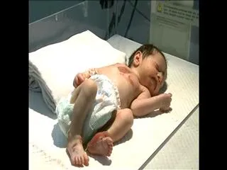 baby born with dangerous disease - Sakshi