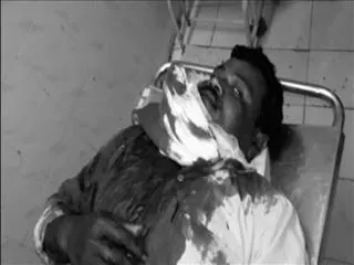 Two brothers fight with gun,one injured - Sakshi