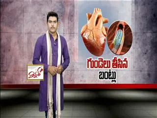​heart patients stents rate issue in ​hospitals - Sakshi