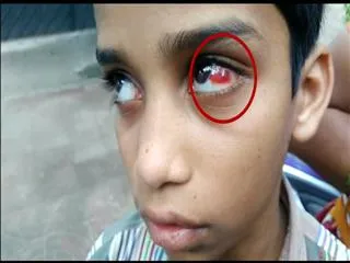 Hostel warden beats Student - Sakshi