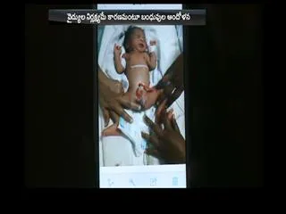 Baby born with defects, organ in Hyderabad - Sakshi
