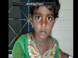 sravani died due to street dogs attack - Sakshi