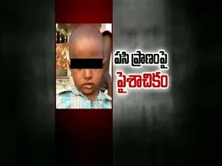 Four-year-old boy brutally tortured by stepmother - Sakshi
