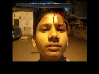 Inter student beaten for being late - Sakshi
