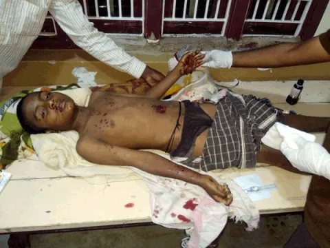 remote car blast..boy injured - Sakshi