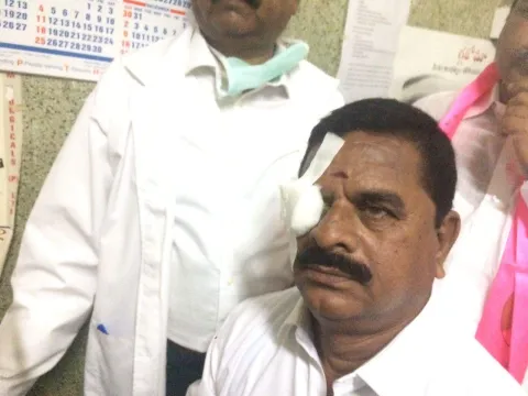 Swamy Goud Eye Treatment  in Sarojini Hospital - Sakshi