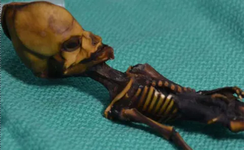 A Tiny Skeleton Found In Chile Might Look Like An Alien - Sakshi