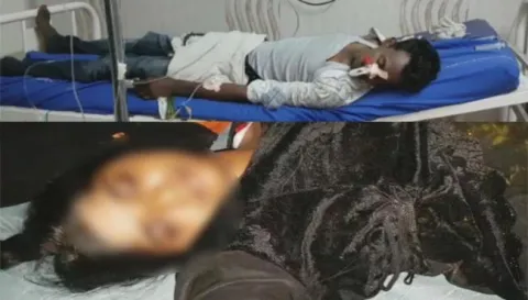 Lovers Suicide Attempt At In Guntur Vinukonda - Sakshi