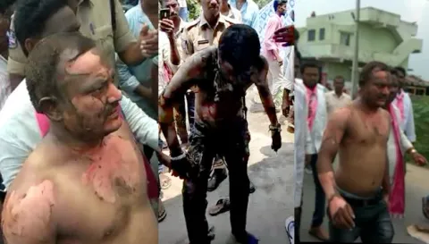 Nallala Odelu Activists Suicide Attempt In Jaipur Mandal - Sakshi