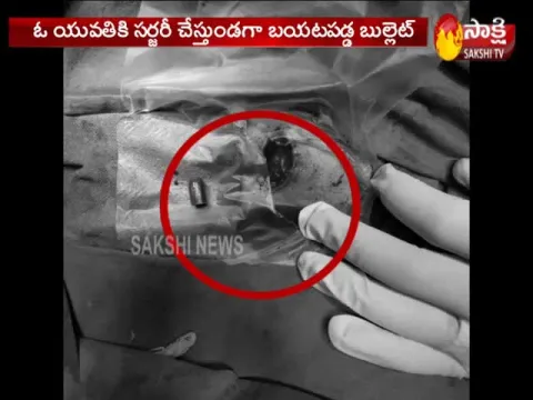 Bullet found in Woman's body