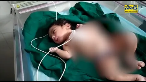 Kamareddy: Mother Ends Her Life After Giving Birth To Baby